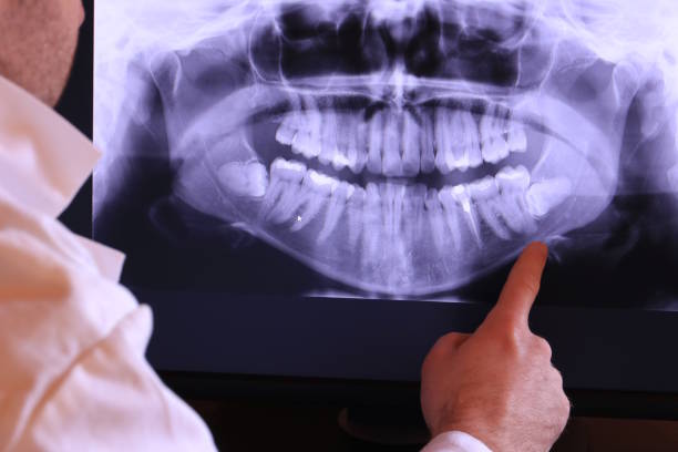Best Orthodontic Emergency Dentist in Aurora, TX