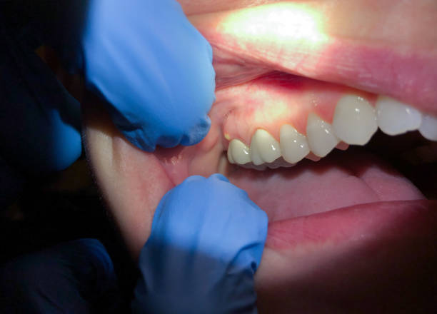 Best Orthodontic Emergency Dentist in Aurora, TX