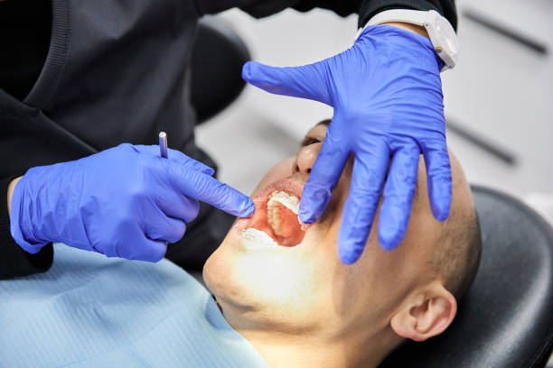 Best Emergency Dentist for Knocked-Out Tooth in Aurora, TX